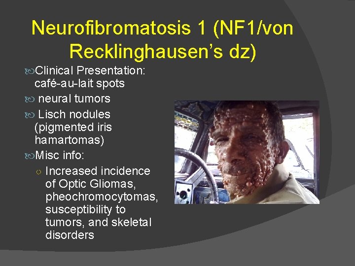 Neurofibromatosis 1 (NF 1/von Recklinghausen’s dz) Clinical Presentation: café-au-lait spots neural tumors Lisch nodules