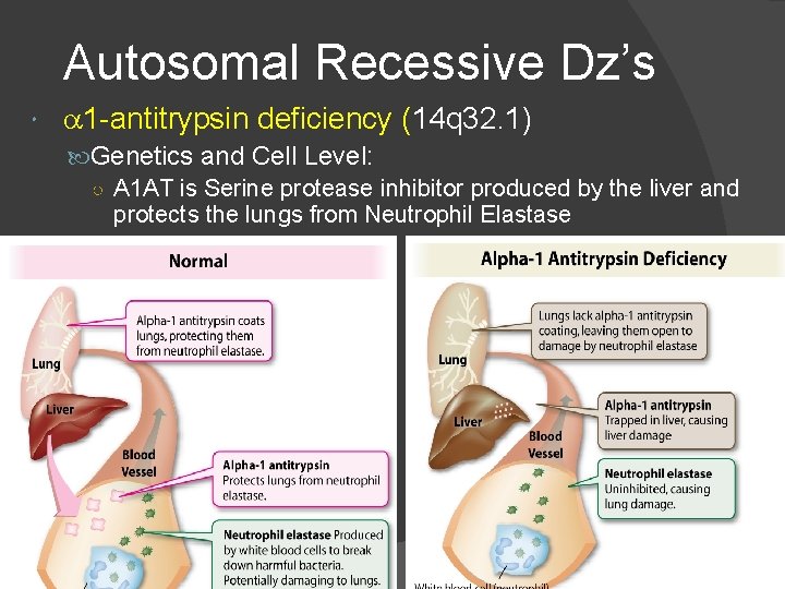 Autosomal Recessive Dz’s a 1 -antitrypsin deficiency (14 q 32. 1) Genetics and Cell