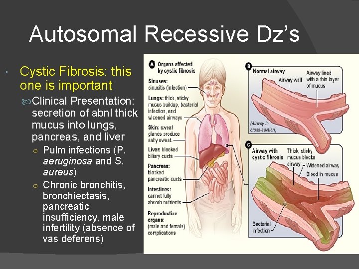 Autosomal Recessive Dz’s Cystic Fibrosis: this one is important Clinical Presentation: secretion of abnl