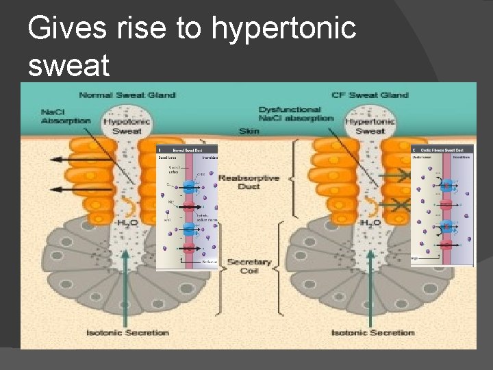 Gives rise to hypertonic sweat 