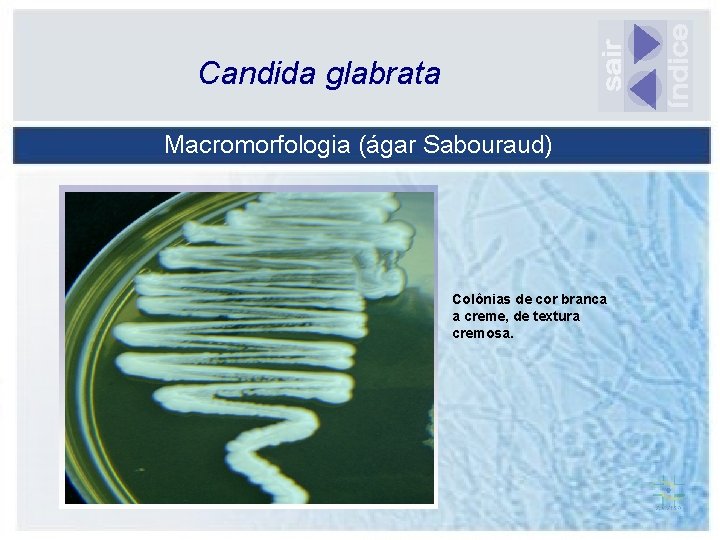 Candida glabrata Macromorfologia (ágar Sabouraud) Colônias de cor branca a creme, de textura cremosa.