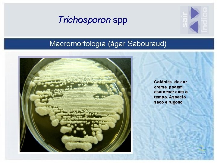 Trichosporon spp Macromorfologia (ágar Sabouraud) Colônias de cor creme, podem escurecer com o tempo.