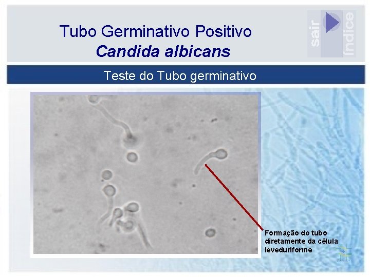 Tubo Germinativo Positivo Candida albicans Teste do Tubo germinativo Formação do tubo diretamente da