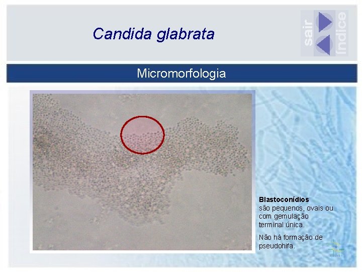 Candida glabrata Micromorfologia Blastoconídios são pequenos, ovais ou com gemulação terminal única. Não há