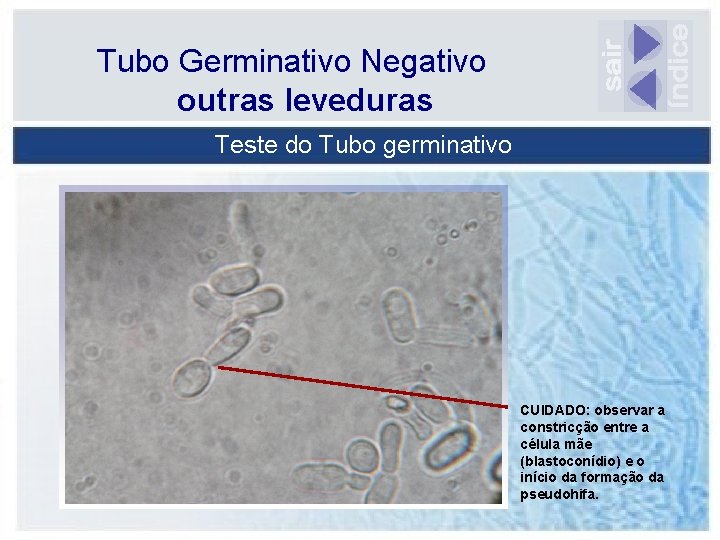 Tubo Germinativo Negativo outras leveduras Teste do Tubo germinativo CUIDADO: observar a constricção entre