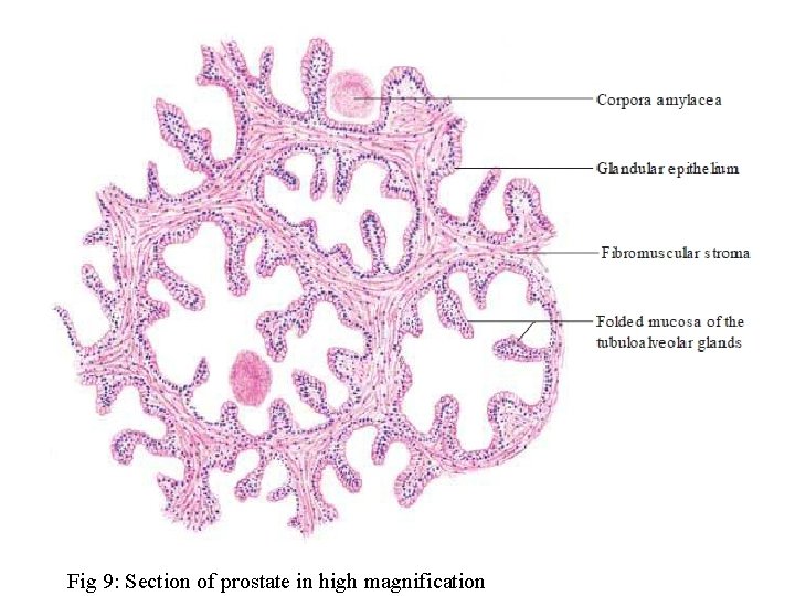 Fig 9: Section of prostate in high magnification 