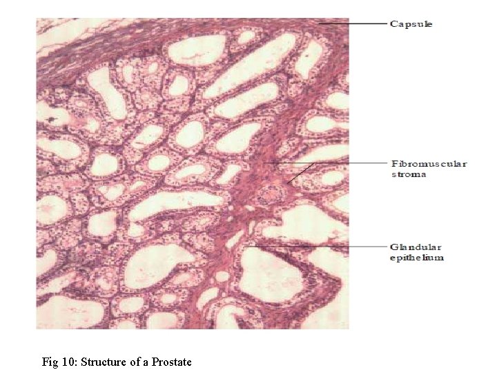 Fig 10: Structure of a Prostate 