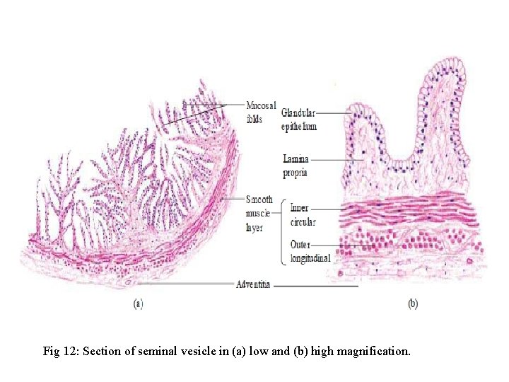 Fig 12: Section of seminal vesicle in (a) low and (b) high magnification. 