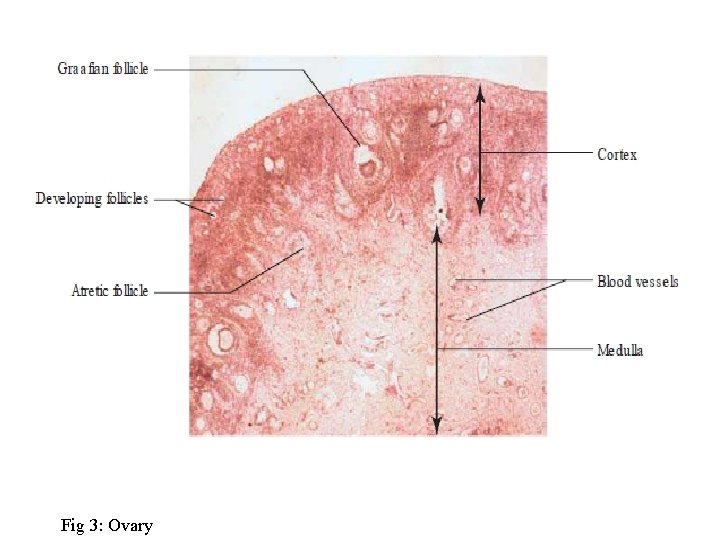 Fig 3: Ovary 