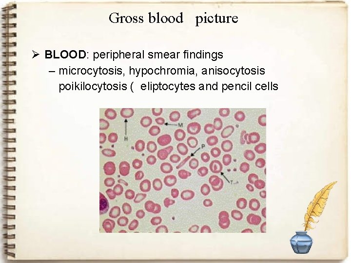 Gross blood picture Ø BLOOD: peripheral smear findings – microcytosis, hypochromia, anisocytosis poikilocytosis (