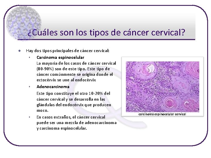 ¿Cuáles son los tipos de cáncer cervical? l Hay dos tipos principales de cáncer