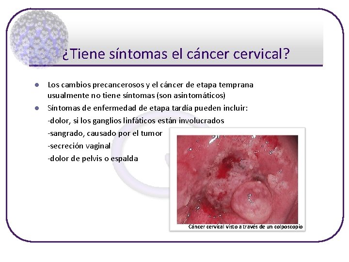 ¿Tiene síntomas el cáncer cervical? l l Los cambios precancerosos y el cáncer de