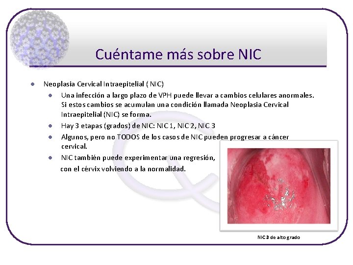 Cuéntame más sobre NIC l Neoplasia Cervical Intraepitelial ( NIC) l Una infección a