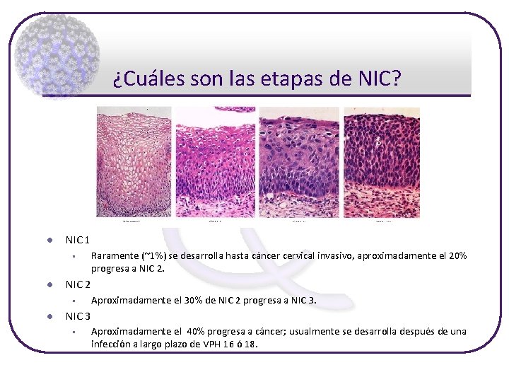 ¿Cuáles son las etapas de NIC? l NIC 1 § l NIC 2 §