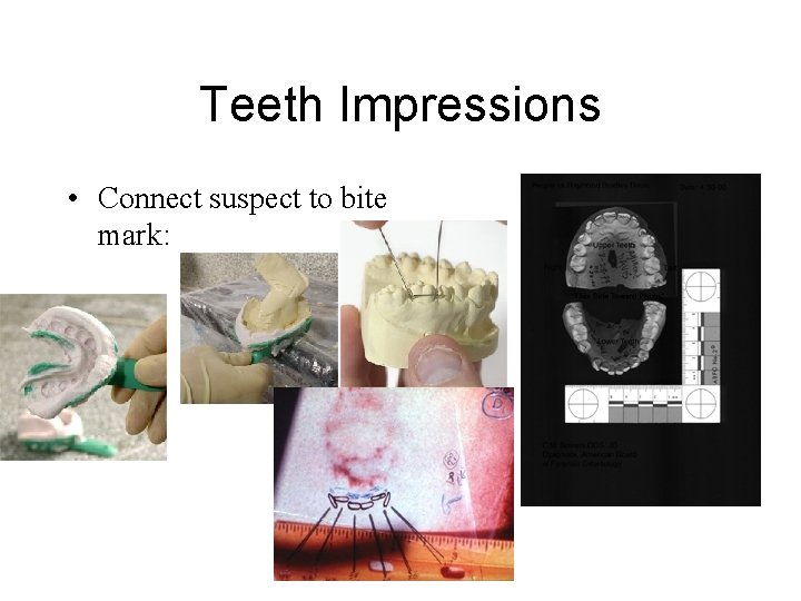 Teeth Impressions • Connect suspect to bite mark: 