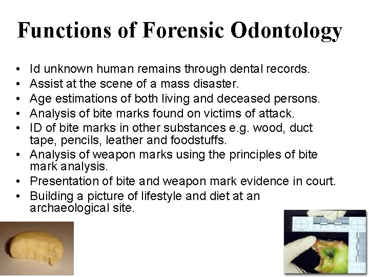 Functions of Forensic Odontology • • • Id unknown human remains through dental records.
