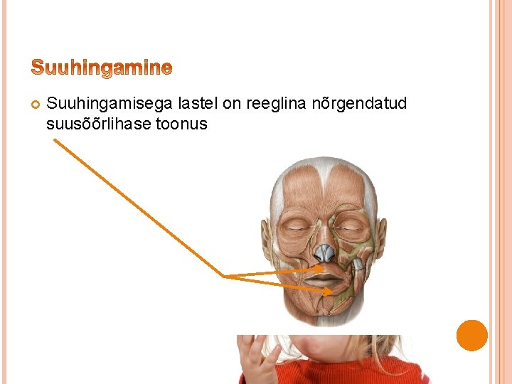  Suuhingamisega lastel on reeglina nõrgendatud suusõõrlihase toonus 