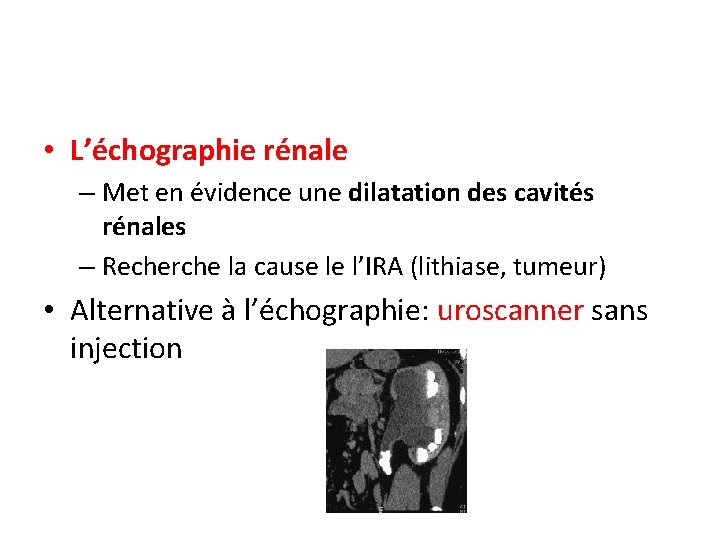  • L’échographie rénale – Met en évidence une dilatation des cavités rénales –