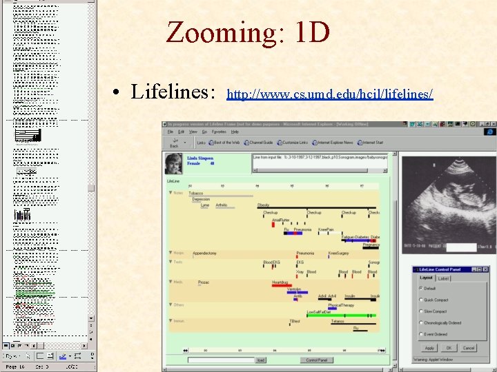 Zooming: 1 D • Lifelines: http: //www. cs. umd. edu/hcil/lifelines/ 