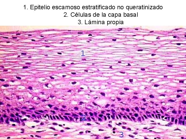 1. Epitelio escamoso estratificado no queratinizado 2. Células de la capa basal 3. Lámina