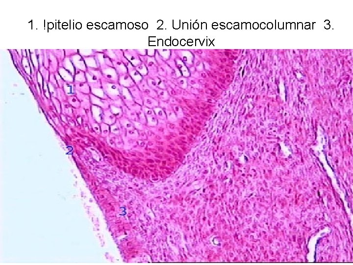 1. !pitelio escamoso 2. Unión escamocolumnar 3. Endocervix 