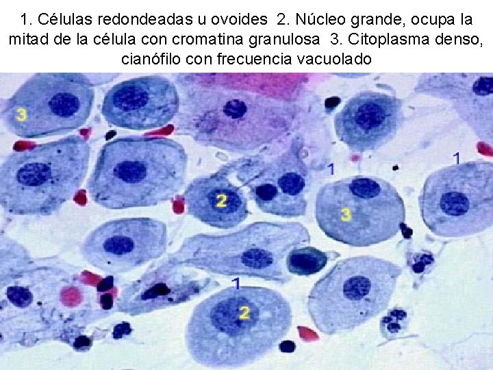 1. Células redondeadas u ovoides 2. Núcleo grande, ocupa la mitad de la célula
