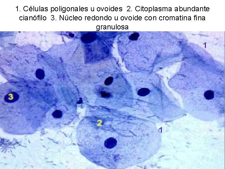 1. Células poligonales u ovoides 2. Citoplasma abundante cianófilo 3. Núcleo redondo u ovoide