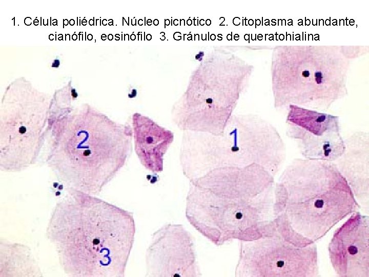 1. Célula poliédrica. Núcleo picnótico 2. Citoplasma abundante, cianófilo, eosinófilo 3. Gránulos de queratohialina