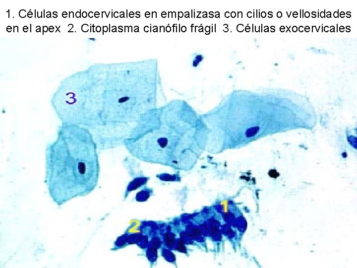 1. Células endocervicales en empalizasa con cilios o vellosidades en el apex 2. Citoplasma