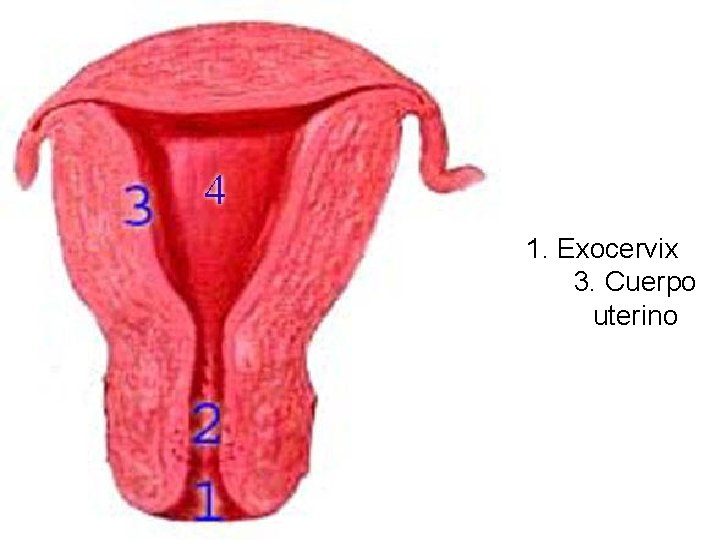 1. Exocervix 3. Cuerpo uterino 