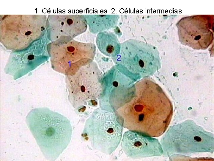 1. Células superficiales 2. Células intermedias 