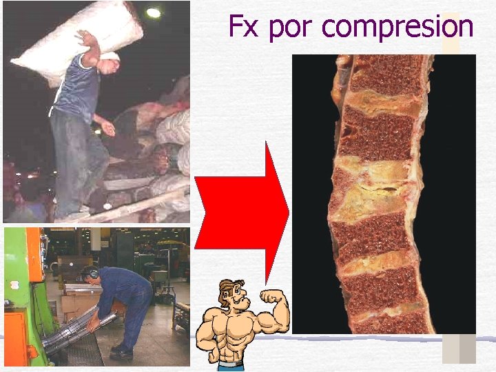 Fx por compresion 