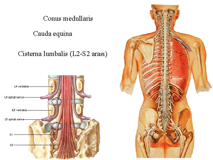 Conus medullaris Cauda equina Cisterna lumbalis (L 2 -S 2 arası) 