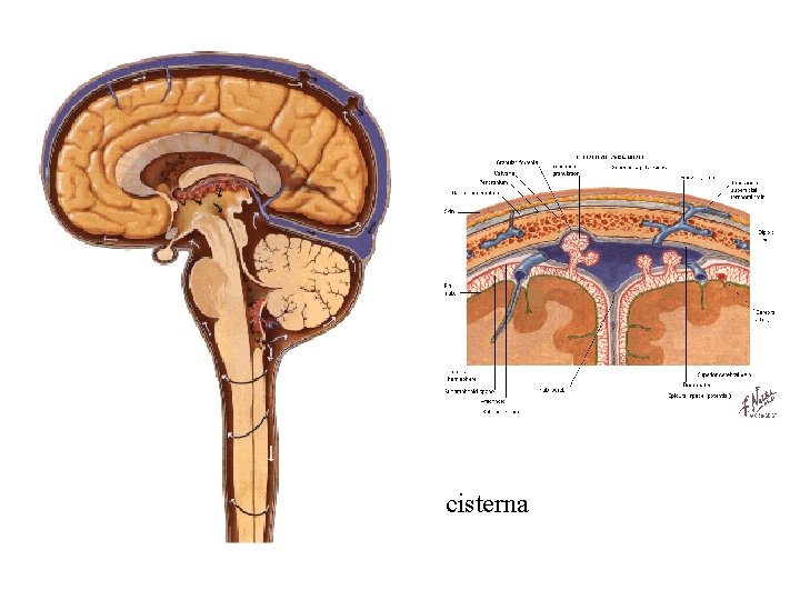 cisterna 