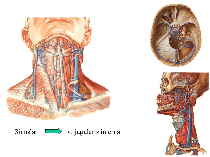 Sinuslar v. jugularis interna 