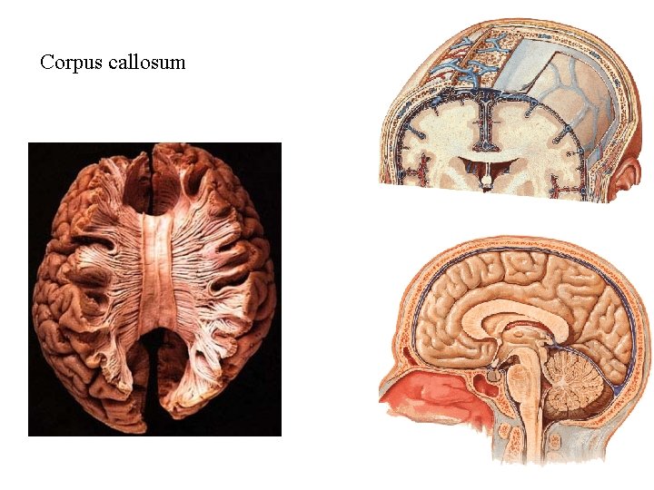 Corpus callosum 