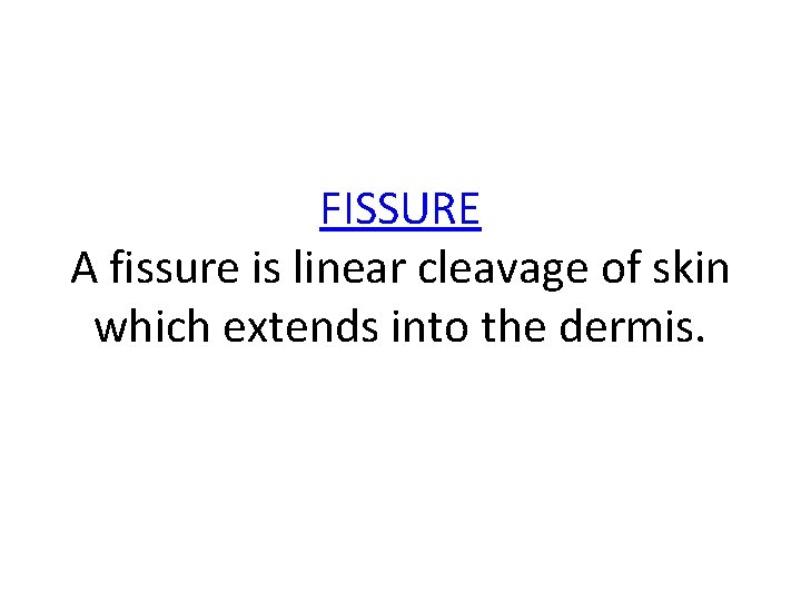 FISSURE A fissure is linear cleavage of skin which extends into the dermis. 