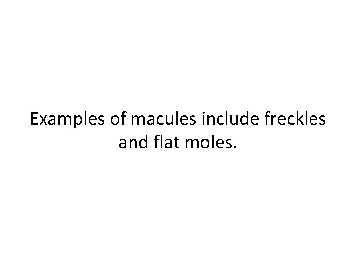 Examples of macules include freckles and flat moles. 