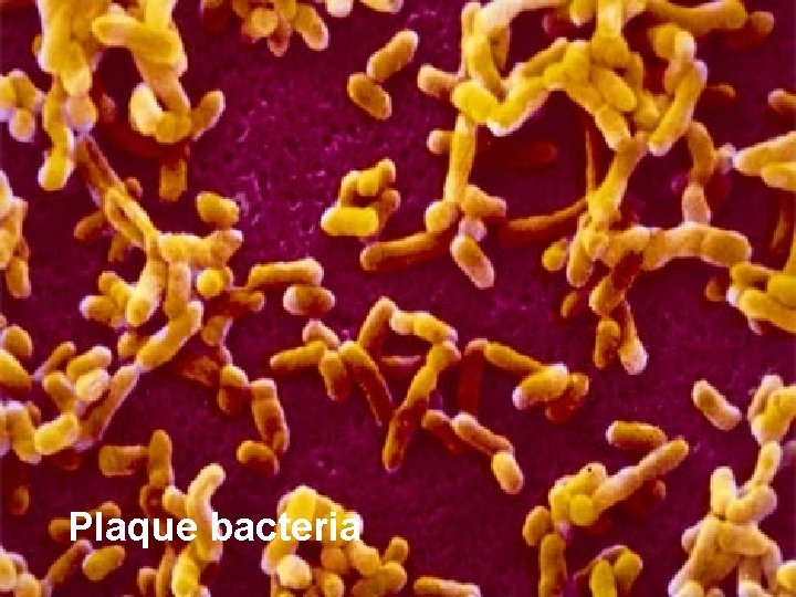 Plaque bacteria 
