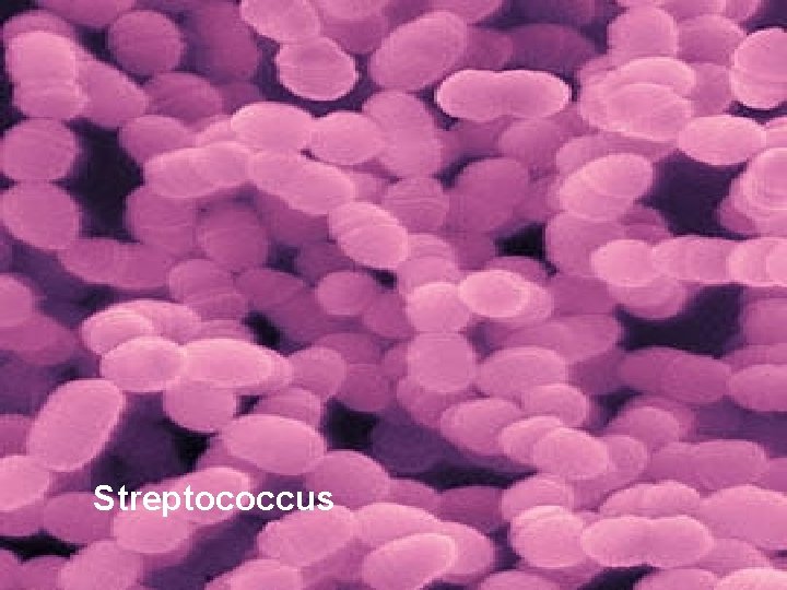 Streptococcus 