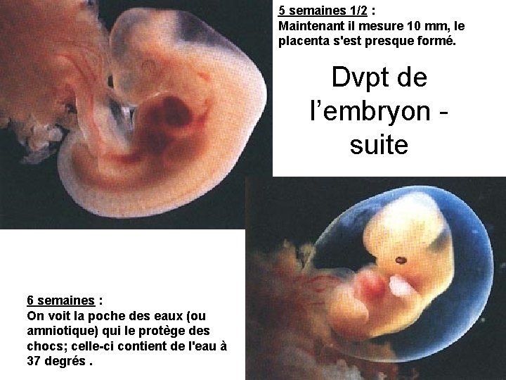 5 semaines 1/2 : Maintenant il mesure 10 mm, le placenta s'est presque formé.