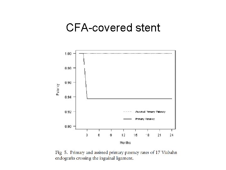 CFA-covered stent 