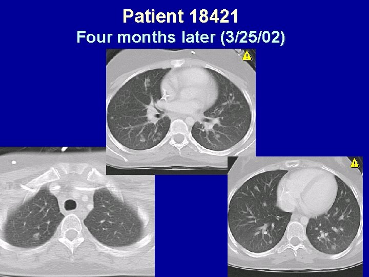 Patient 18421 Four months later (3/25/02) 