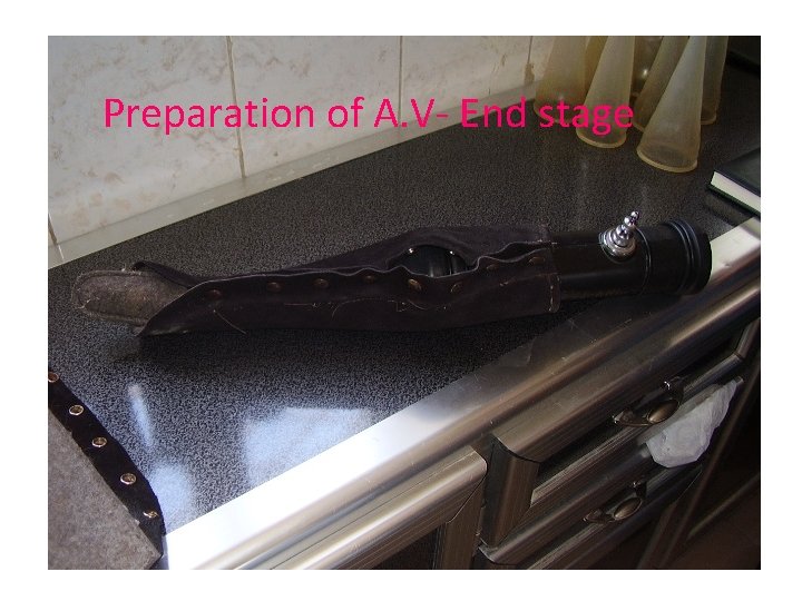 Preparation of A. V- End stage 