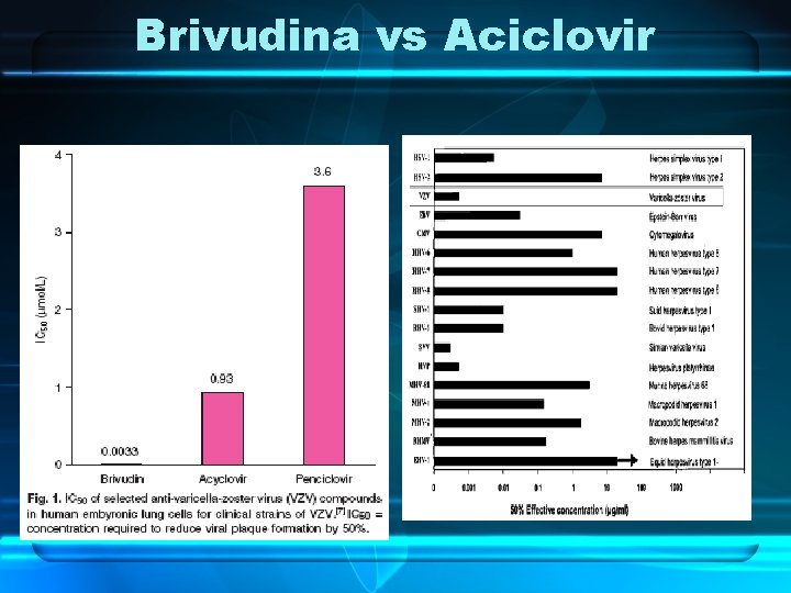 Brivudina vs Aciclovir 