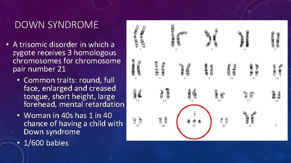 DOWN SYNDROME • A trisomic disorder in which a zygote receives 3 homologous chromosomes