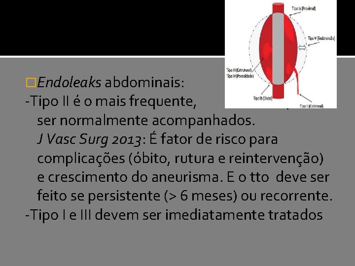 �Endoleaks abdominais: -Tipo II é o mais frequente, podem ser normalmente acompanhados. J Vasc