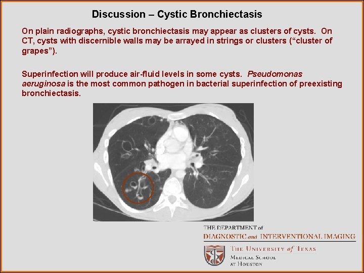 Discussion – Cystic Bronchiectasis On plain radiographs, cystic bronchiectasis may appear as clusters of