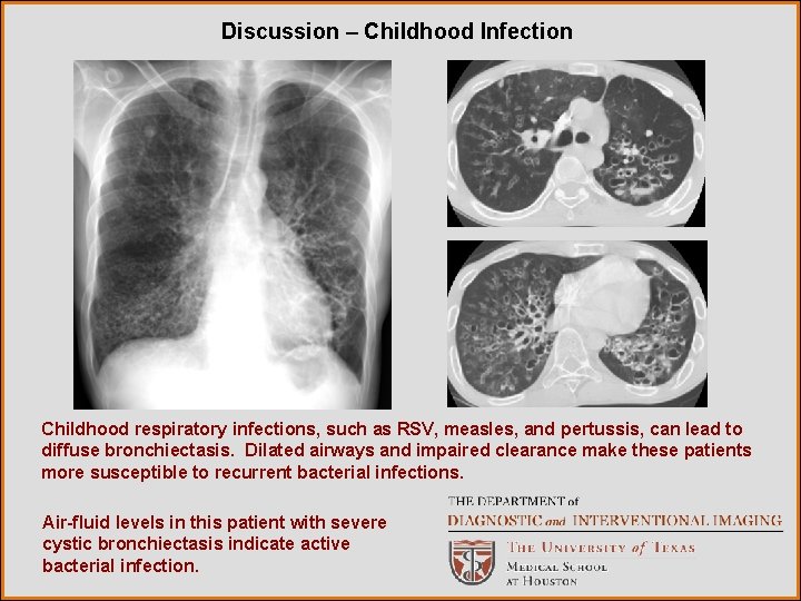 Discussion – Childhood Infection Childhood respiratory infections, such as RSV, measles, and pertussis, can