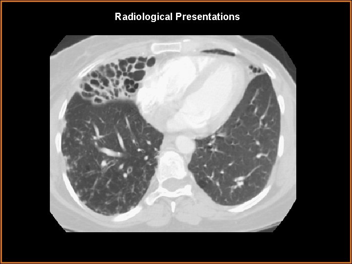 Radiological Presentations Radiological Presentations